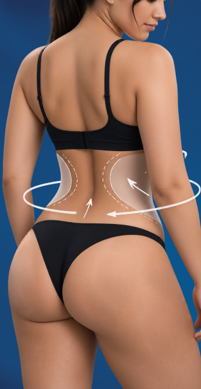 Referencia visual del contorno posterior para Lipo 360