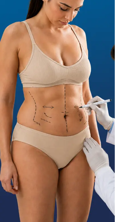 Referencia visual de una evaluación de lipoescultura
